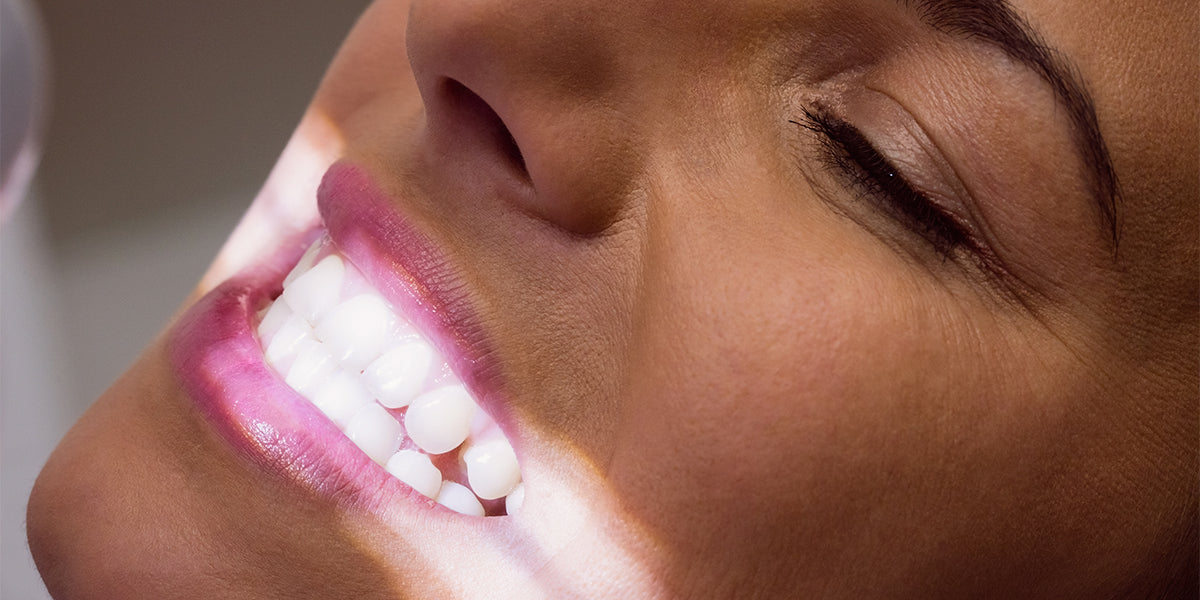 Understanding and Addressing Translucent Teeth