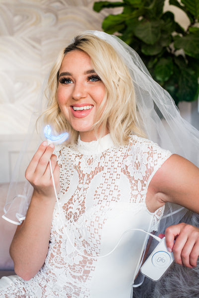DIY: Sparkling White Teeth For Your Wedding Day